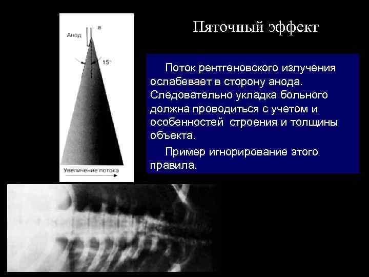 Пяточный эффект Поток рентгеновского излучения ослабевает в сторону анода. Следовательно укладка больного должна проводиться