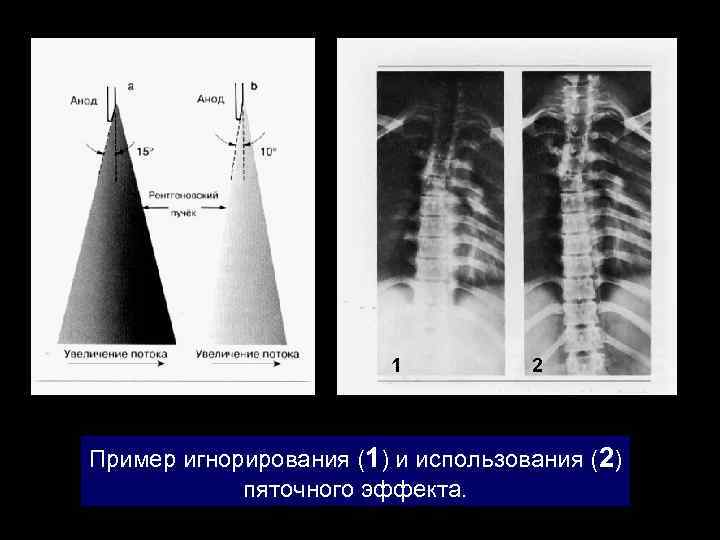 1 2 Пример игнорирования (1) и использования (2) пяточного эффекта. 