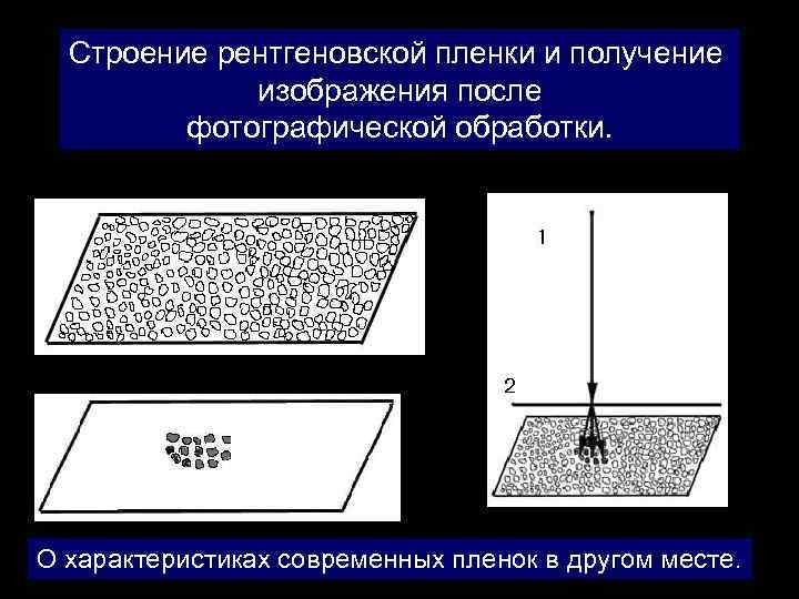 Строение рентгеновской пленки и получение изображения после фотографической обработки. О характеристиках современных пленок в