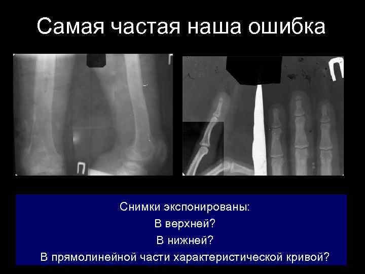 Самая частая наша ошибка Снимки экспонированы: В верхней? В нижней? В прямолинейной части характеристической