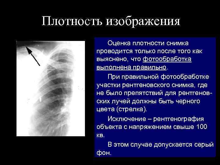 Плотность изображения Оценка плотности снимка проводится только после того как выяснено, что фотообработка выполнена