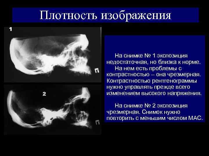 Контраст между деталями рентгеновского изображения главным образом обусловлен