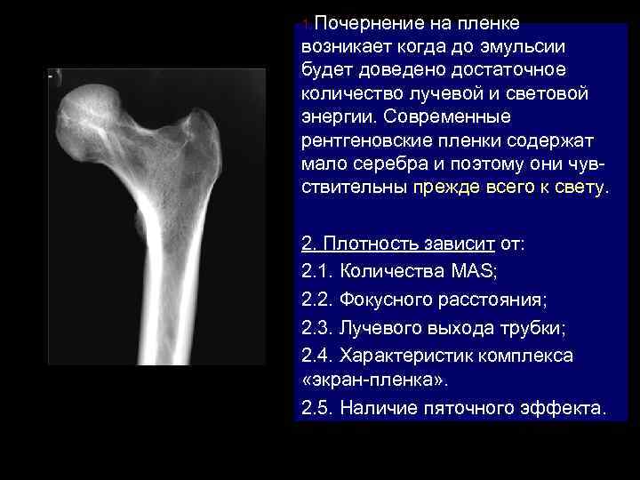 1. Почернение на пленке возникает когда до эмульсии будет доведено достаточное количество лучевой и