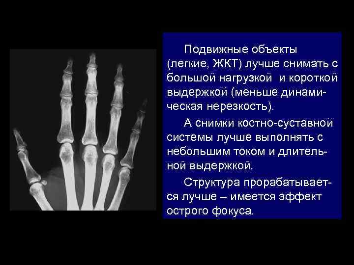 Подвижные объекты (легкие, ЖКТ) лучше снимать с большой нагрузкой и короткой выдержкой (меньше динамическая