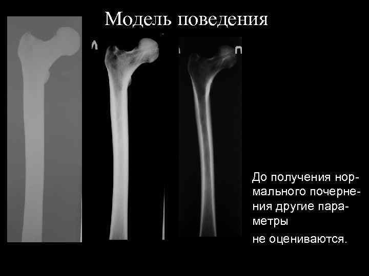 Модель поведения До получения нормального почернения другие параметры не оцениваются. 