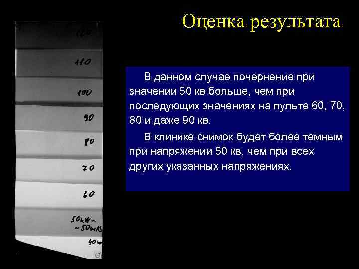 Оценка результата В данном случае почернение при значении 50 кв больше, чем при последующих