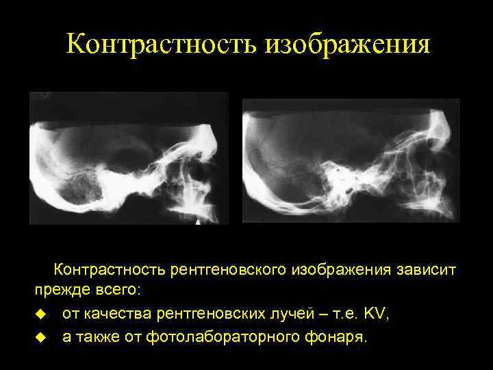 Индикатор качества изображения при радиографическом контроле