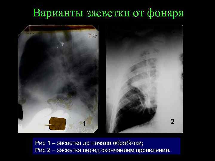 Варианты засветки от фонаря 11 Рис 1 – засветка до начала обработки; Рис 2