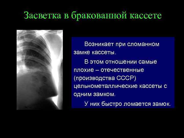 Засветка в бракованной кассете Возникает при сломанном замке кассеты. В этом отношении самые плохие