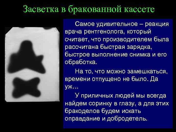 Засветка в бракованной кассете Самое удивительное – реакция врача рентгенолога, который считает, что производителем