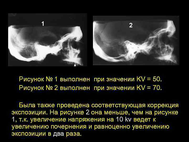 1 2 Рисунок № 1 выполнен при значении KV = 50. Рисунок № 2