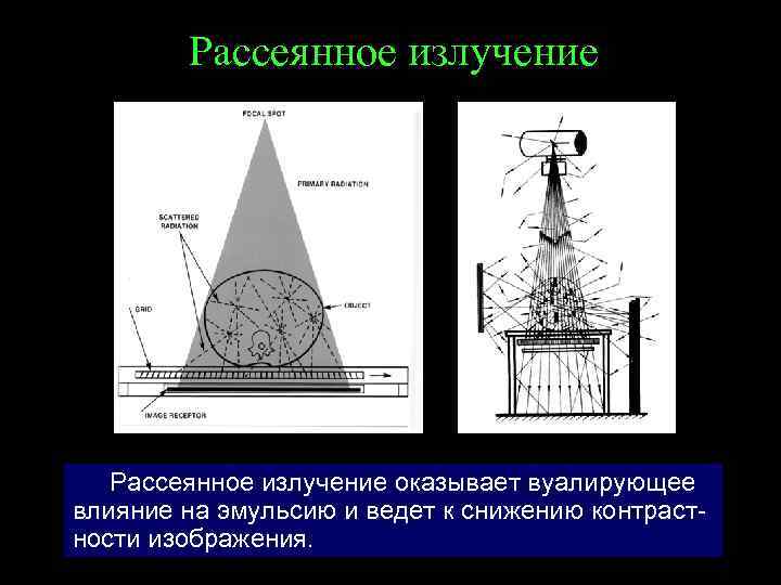 Рассеянное излучение оказывает вуалирующее влияние на эмульсию и ведет к снижению контрастности изображения. 