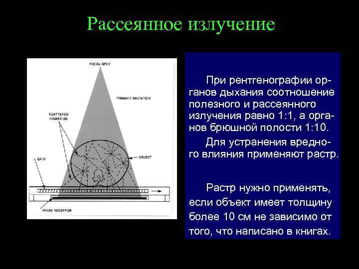 Уменьшение размеров изображения при рентгенографии по сравнению с размерами объекта может быть