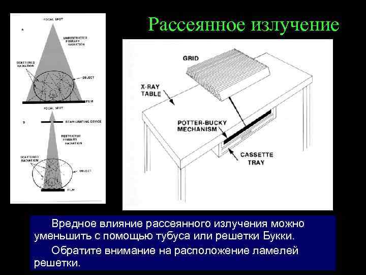 Рассеянное излучение Вредное влияние рассеянного излучения можно уменьшить с помощью тубуса или решетки Букки.