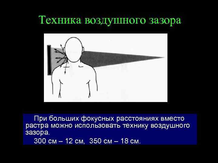 Техника воздушного зазора При больших фокусных расстояниях вместо растра можно использовать технику воздушного зазора.