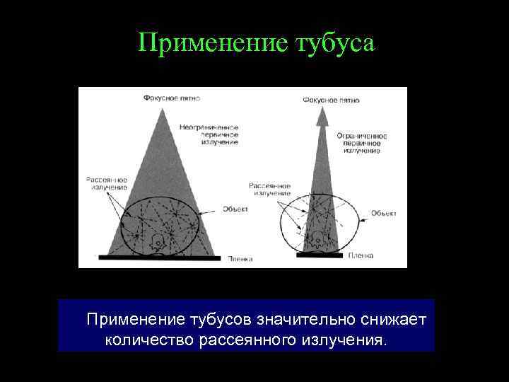 Применение тубуса Применение тубусов значительно снижает количество рассеянного излучения. 