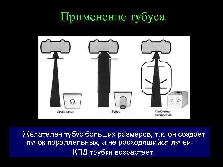 Применение тубуса Желателен тубус больших размеров, т. к. он создает пучок параллельных, а не