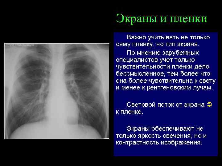 Экраны и пленки Важно учитывать не только саму пленку, но тип экрана. По мнению