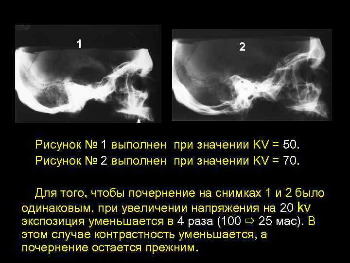 1 2 Рисунок № 1 выполнен при значении KV = 50. Рисунок № 2