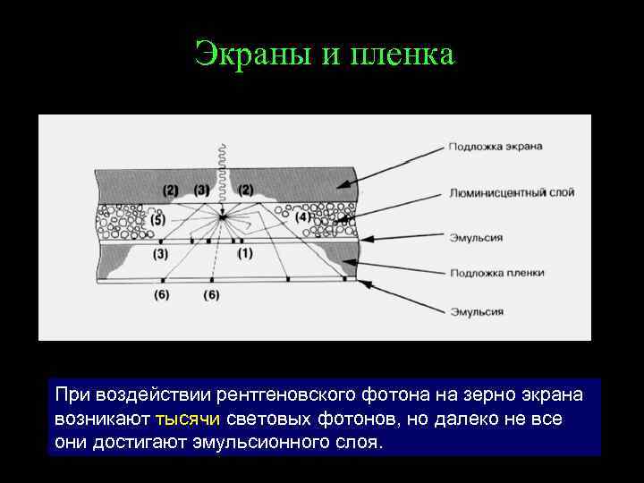 Экраны и пленка При воздействии рентгеновского фотона на зерно экрана возникают тысячи световых фотонов,