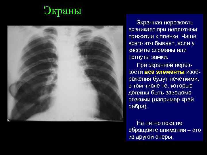 Экраны Экранная нерезкость возникает при неплотном прижатии к пленке. Чаще всего это бывает, если