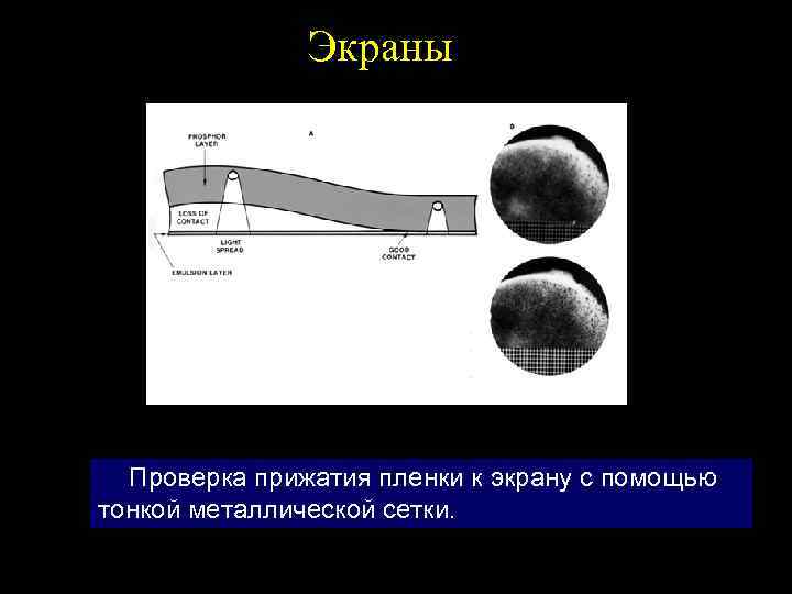 Экраны Проверка прижатия пленки к экрану с помощью тонкой металлической сетки. 