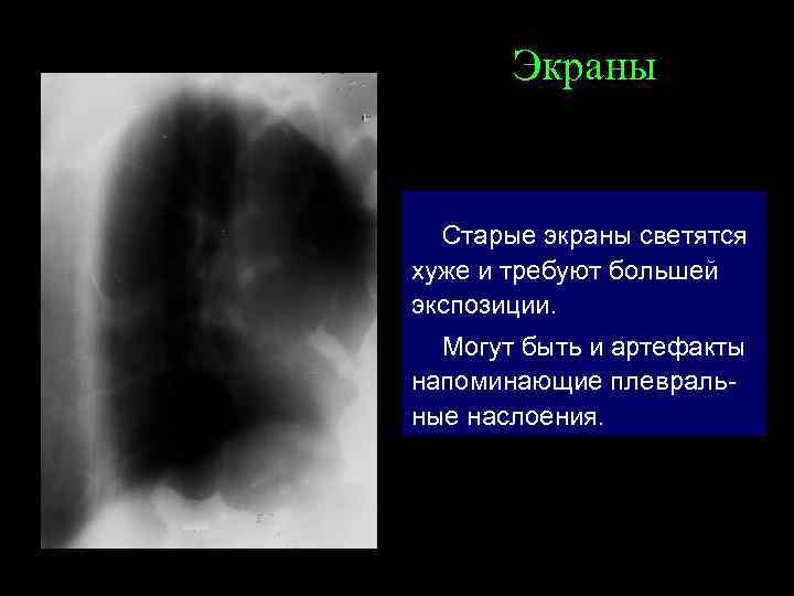 Экраны Старые экраны светятся хуже и требуют большей экспозиции. Могут быть и артефакты напоминающие