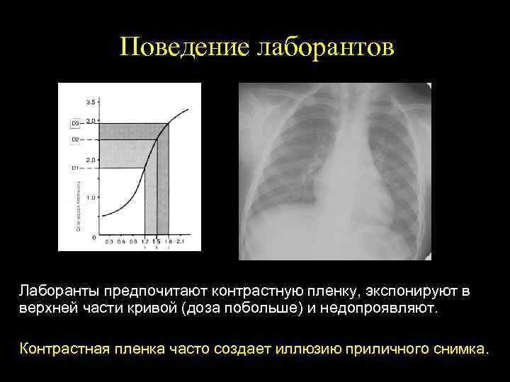 Поведение лаборантов Лаборанты предпочитают контрастную пленку, экспонируют в верхней части кривой (доза побольше) и