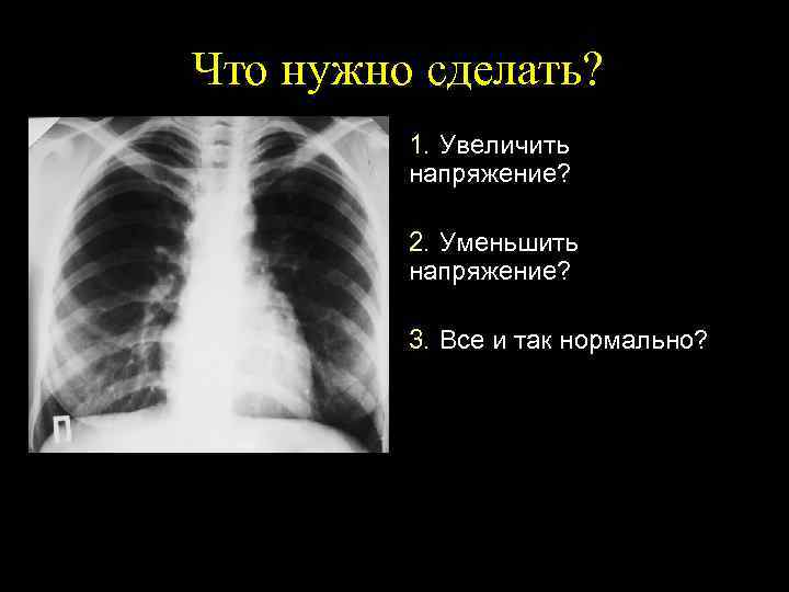 Что нужно сделать? 1. Увеличить напряжение? 2. Уменьшить напряжение? 3. Все и так нормально?