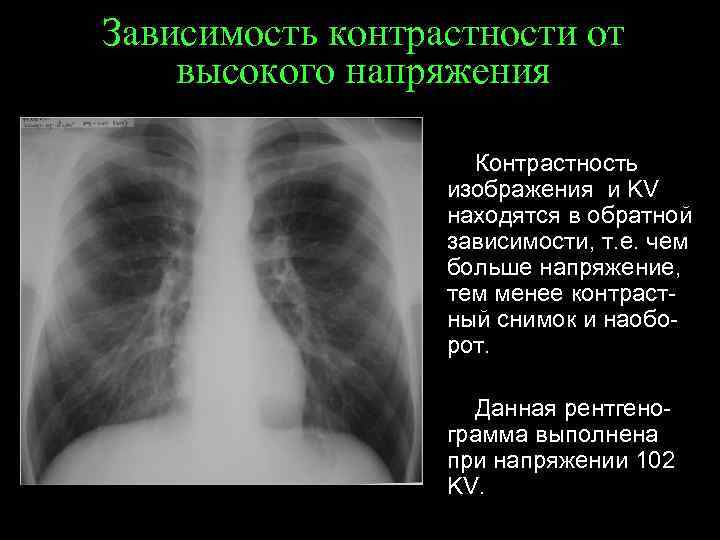 Зависимость контрастности от высокого напряжения Контрастность изображения и KV находятся в обратной зависимости, т.