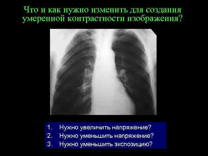 Что и как нужно изменить для создания умеренной контрастности изображения? 1. 2. 3. Нужно