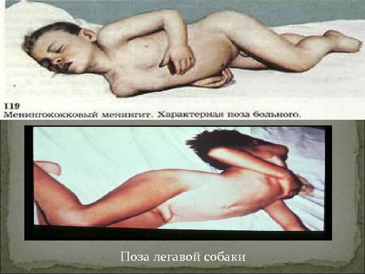 Поза легавой собаки 