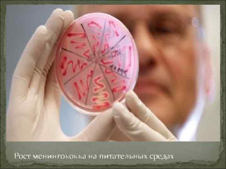 Рост менингококка на питательных средах 
