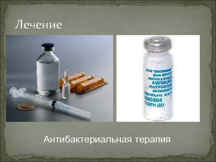 Лечение Антибактериальная терапия 