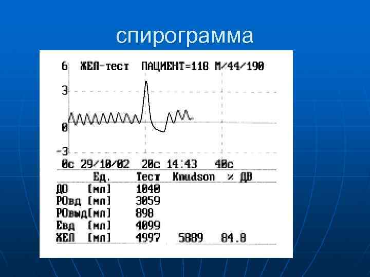 Что такое спирография фото