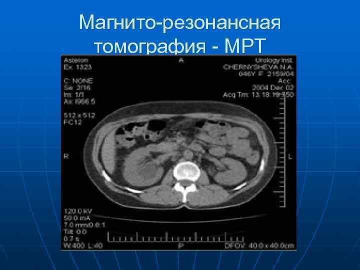 Магнито-резонансная томография - МРТ 