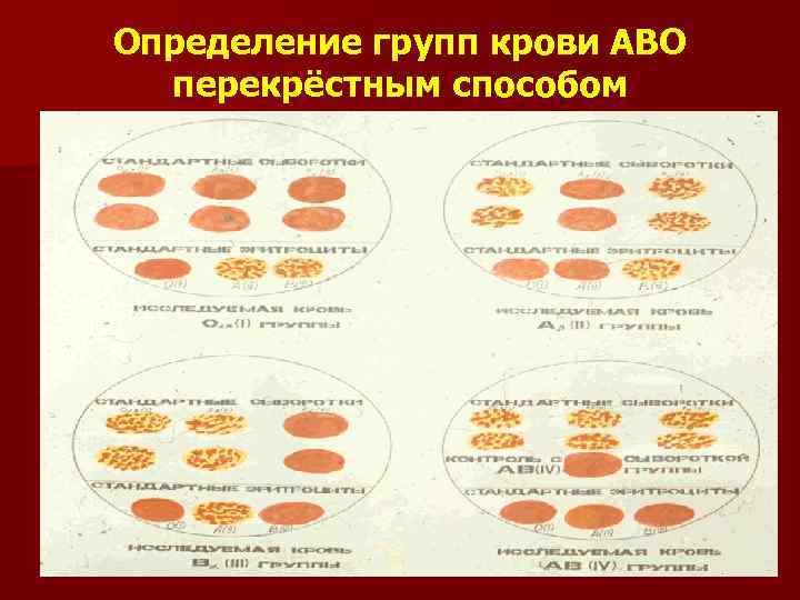 Основы гемотрансфузиологии презентация