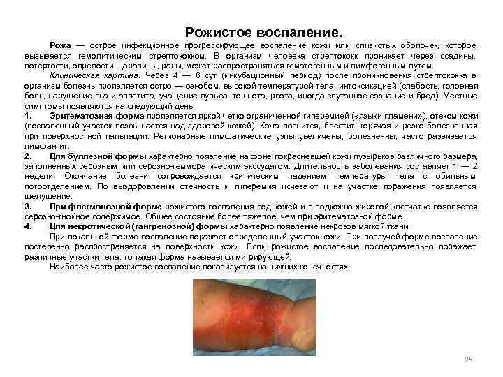        Рожистое воспаление.   Рожа — острое