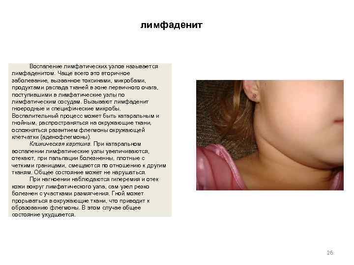        лимфаденит   Воспаление лимфатических узлов называется