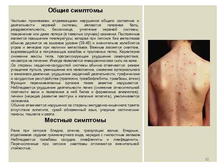      Общие симптомы Частыми признаками,  отражающими нарушения общего состояния