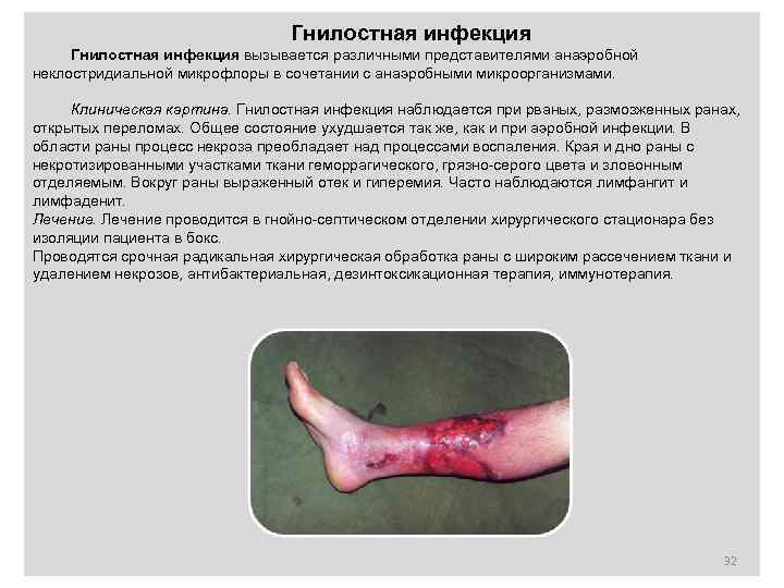       Гнилостная инфекция вызывается различными представителями анаэробной неклостридиальной микрофлоры