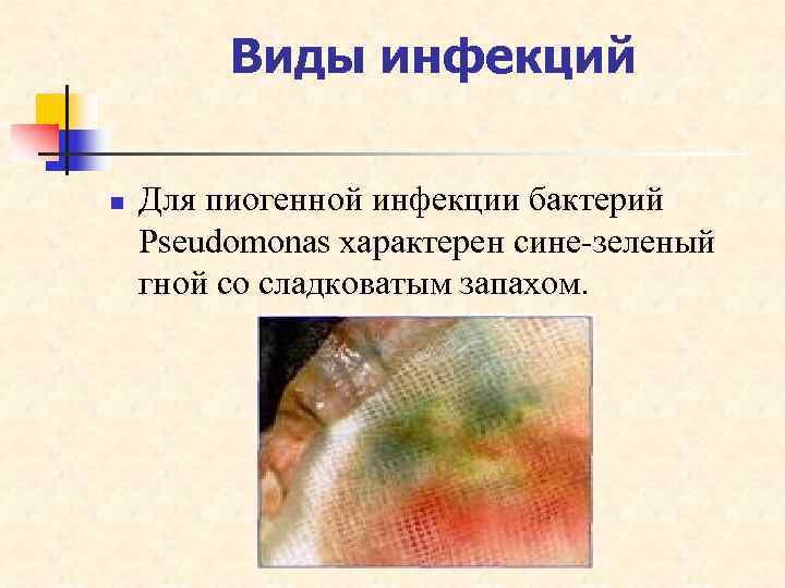    Виды инфекций n  Для пиогенной инфекции бактерий Pseudomonas характерен сине-зеленый