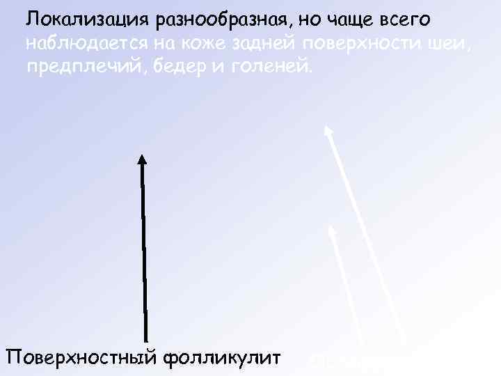  Локализация разнообразная, но чаще всего наблюдается на коже задней поверхности шеи,  предплечий,