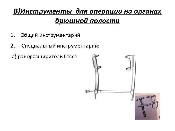  В)Инструменты для операции на органах  брюшной полости 1. Общий инструментарий 2. 