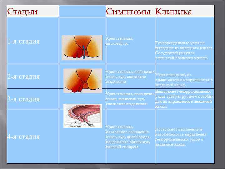  Стадии  Симптомы Клиника     Кровотечения,  1 -я стадия