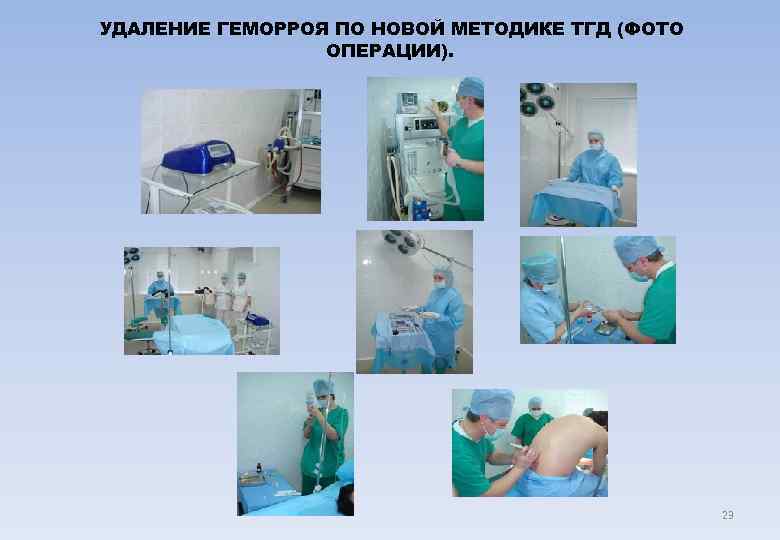 УДАЛЕНИЕ ГЕМОРРОЯ ПО НОВОЙ МЕТОДИКЕ ТГД (ФОТО   ОПЕРАЦИИ).    