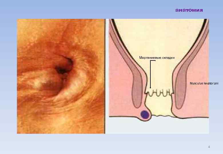      анатомия Морганиевые складки      Musculus