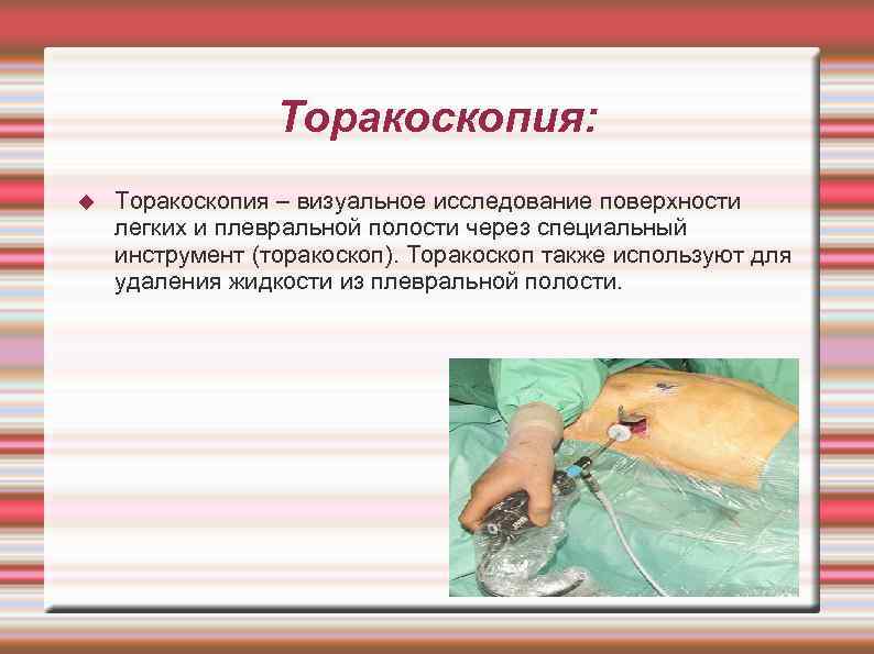    Торакоскопия: Торакоскопия – визуальное исследование поверхности легких и плевральной полости через