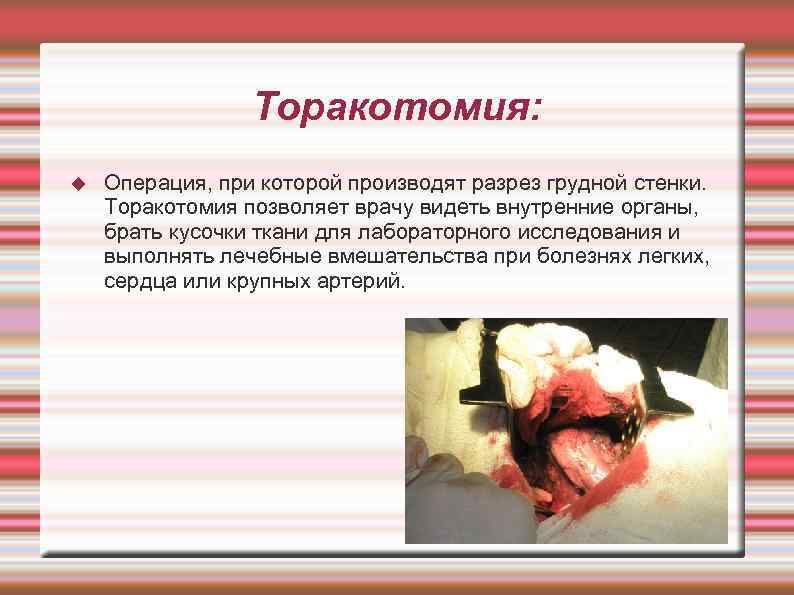    Торакотомия: Операция, при которой производят разрез грудной стенки. Торакотомия позволяет врачу