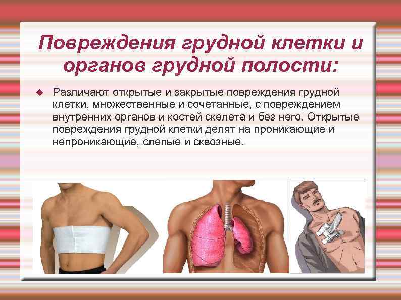 Повреждения грудной клетки и  органов грудной полости: Различают открытые и закрытые повреждения грудной